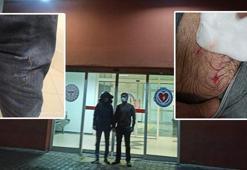 Köpeklerin saldırısına uğrayan baba- oğul yaralandı