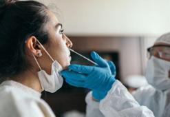 PCR testi kaldırıldı mı? Kimlere PCR testi yapılacak? Sempton gösterenlere PCR testi yapılacak mı?