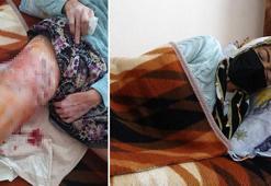 Antalya'da Pitbull dehşeti! 2 çocuk annesi kadını bu hale getirdi