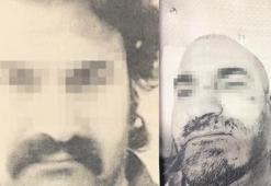 Öğrenci yurdunda sıcak ağda dehşeti! Saçını ve sakallarını kopardı