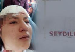 Özçekim yaparken ölümden döndü! Sokak köpekleri...