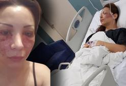 'Örümcek ağı' kabusu! Bulgar model tanınmaz hale geldi