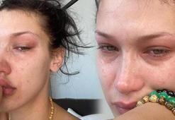 Bella Hadid: Çocukken ailenin utanç kaynağı gibi hissediyordum