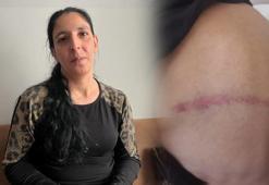 Ölüm tehdidi alan kadının yardım çığlığı: Benim ölmemi mi bekliyor adalet!