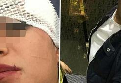 Eski eşiyle ilişkisi olan arkadaşını jiletle kesti!