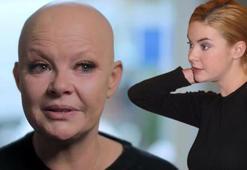 Dünyaca ünlü isim Gail Porter'dan kötü haber! "Beni hiçbir şey yıkamaz"