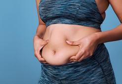 Obezite problemi ameliyatsız tedavi edilebilir mi?