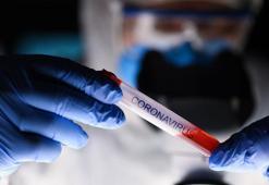 Koronavirüs ölümden sonra bile peşini bırakmadı! Sonuçlar doktorları şaşırttı: Ölümünden sonraki altı hafta içinde...