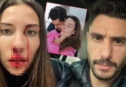 Özer Hurmacı'ya 3 yıl 6 ay, Mihriban Hurmacı'ya 5 yıl 6 aya kadar hapis talebi!