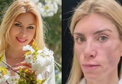 Rus güzellik kraliçesi Yulia Tarasevich’in hayatı kabus oldu! Gözlerini kapatamıyor