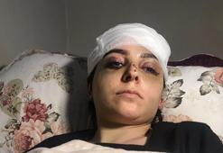 Sultangazi'de tayt dayağı: Karısını hastanelik etti, serbest kaldı