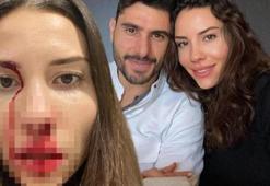 Mihriban Hurmacı, Özer Hurmacı'dan 20 milyon TL istedi!