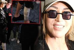 Hande Yener ayağı sargılı ödül töreninde! "Bacak nazarmış öyle diyorlar"