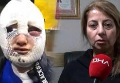 Eski sözlüsünün başından aşağı kızgın yağ döken sanığa tahliye