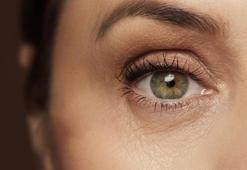 Göz estetiği yaptırmadan önce dikkat! Hafife almayın!