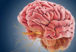 Bruce Willis’in hastalığı afazi nedir, neden olur? Afazi hastalığının belirtileri nelerdir, tedavisi var mı?