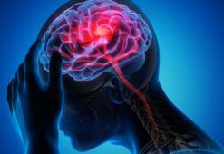 Beyni erken yaşlandırıyor, bu 6 belirtiye dikkat! Alzheimer hastalığı ile...