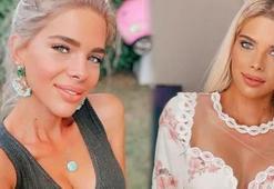 Sihirli Annem'in Tuğçe'si Damla Ersubaşı'dan estetik itirafı!