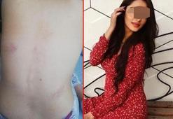 Rezidanstaki iğrenç olayda şok detaylar! 'Çırılçıplak soyup video çektiler'