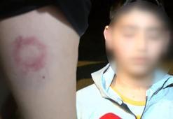 İki kardeş saldırıya uğradı iddiası! 'Annesi beni yerde tutarken çocukla birlikte yumrukluyorlardı'