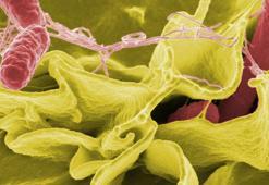 DSÖ: 11 ülkeden 151 Salmonella vakası bildirildi