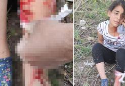 Başıboş köpekler küçük kıza dehşeti yaşattı! Birçok yerinden yaralandı