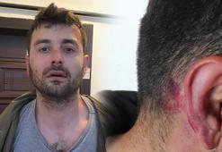 Futbolcu Veysel Sarı'nın kardeşinden kiracıya dayak!