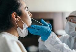 Ameliyat öncesi PCR testi kalktı mı? PCR testi kaldırıldı mı?