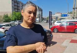 Epilasyon için gittiği güzellik merkezinde dehşeti yaşadı! 'Bu kolla mı gelinlik giyeceğim?'