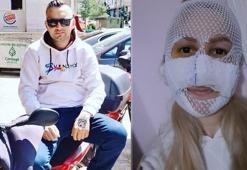 Kız arkadaşının yüzüne kimyasal madde atmıştı! 'Bütün kadınlardan özür dilerim'