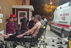 Üzerine asit dökülen işçi ağır yaralandı