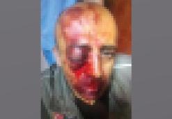 Orman memurunu tanınmaz hale getirdiler! Çok sayıda kişi gözaltına alındı