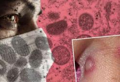 Koronavirüsten sonra kabusun yeni adı Maymun çiçeği virüsü!  Bir ülkeye daha sıçradı: Flaş açıklama geldi...