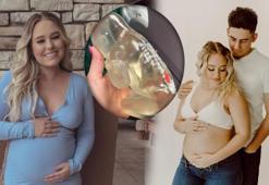 Sosyal medya fenomeni bebeğini ikinci kez doğuracak! Akılalmaz olay tıp dünyasını şoke etti! 18 yaşına gelene kadar...