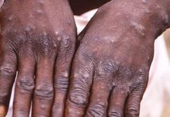 Yeni salgın patladı, dünya panikte! Skandal ‘fetiş festivali’ iddiası...