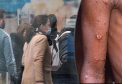 Maymun çiçeği virüsü yayılıyor! ABD'de vaka sayıları artınca CDC aşı kararı verdi...