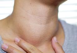 Boyunda şişlik ve kalınlaşma guatr belirtisi olabilir! Guatr hastaları nasıl beslenmeli?