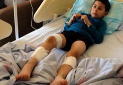 Sokak köpeklerinin saldırısına uğrayan küçük Mustafa yaralandı