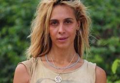 Survivor Duygu Bal'ın son halini gören inanamıyor!