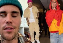 Justin Bieber’dan kötü haber! 'Her şeyi yaptım ama hastalığım giderek kötüleşiyor'