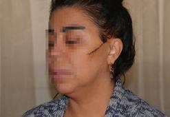 Eski sevgilisinin yüzünü usturayla kesen sanığa 'indirimsiz' 6 yıl hapis