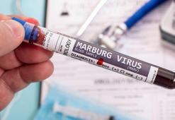 Marburg virüsü nedir, belirtileri ne? Marburg virüsü nasıl bulaşır?