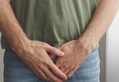 Testis tümörü nedir? Testis tümörü belirtileri nelerdir? Tedavisi var mı?