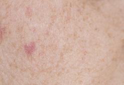 Hızlı büyüyen güneş lekelerine dikkat