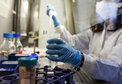 Yeni virüsün adı ne? Yeni vürüsün belirtileri ne? Yeni virüs coronavirüsle bağlantılı mı? Adeno-ilişkili virüs 2 (AAV2) ne demek?