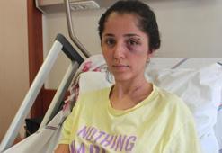 Doktor sevgilisinin evinde dehşeti yaşayan genç kadın 2 saat boyunca darp edildi, 5 yerinden bıçaklandı