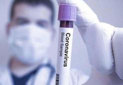 Araştırma: Midkin protein seviyesi koronavirüsün yeni belirtisi olabilir