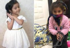 Pitbull saldırısında yaralanan Asiye'nin şoke eden görüntüsü! Annesi tasma takıp, ellerini bağladı ve...