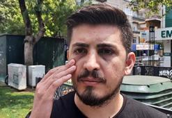 Hemşirenin burnunu kıran hasta yakını bu kez tutuklandı
