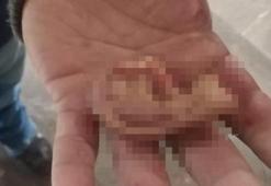 Metroda kan donduran olay! Yolcunun kulağını kopardı